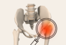 ACTIS® Total Hip System система эндопротезирования — результаты двух лет исследований